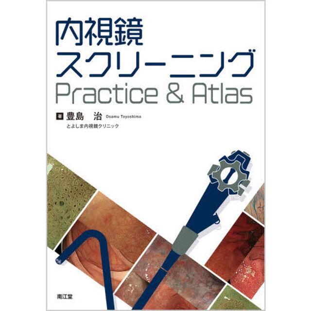 内視鏡スクリーニングＰｒａｃｔｉｃｅ　＆　Ａｔｌａｓ