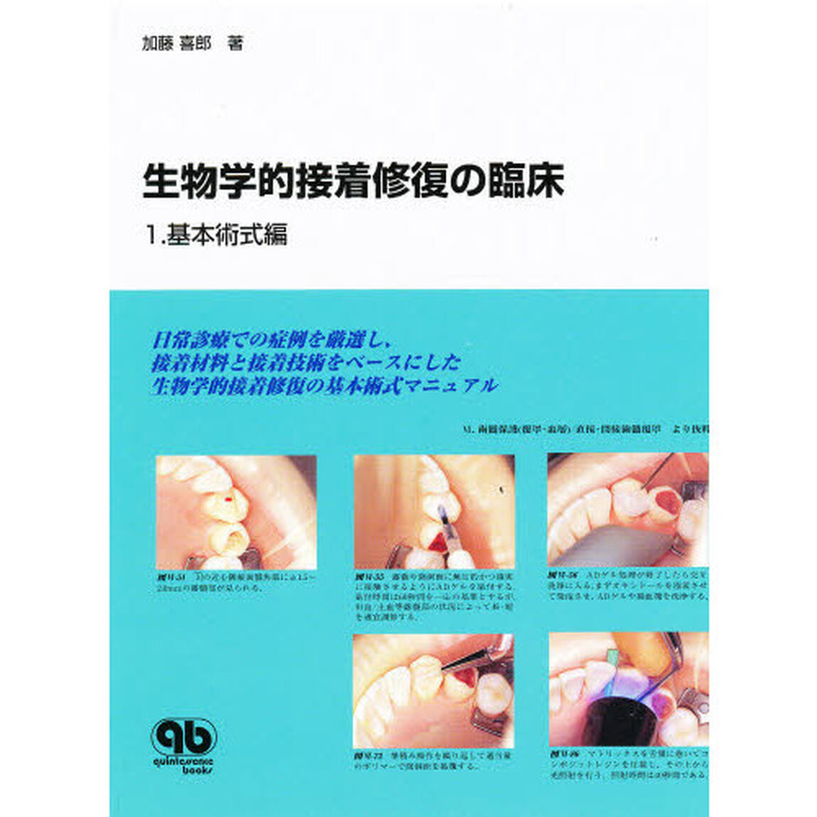 生物学的接着修復の臨床　１「基本術式編」