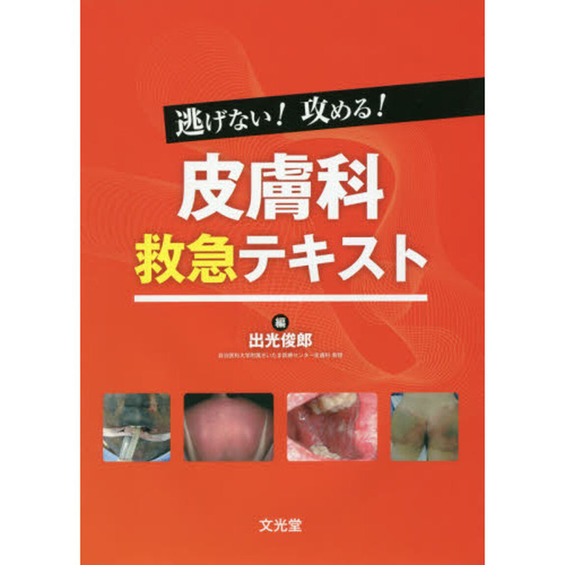 逃げない！攻める！皮膚科救急テキスト