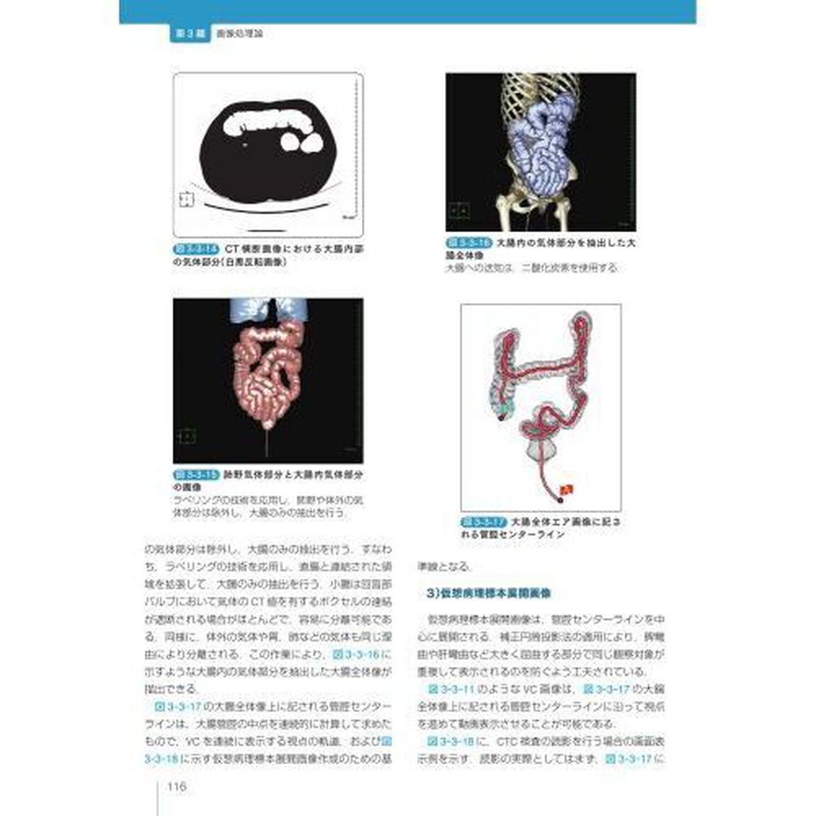 医療画像情報工学「第２版」