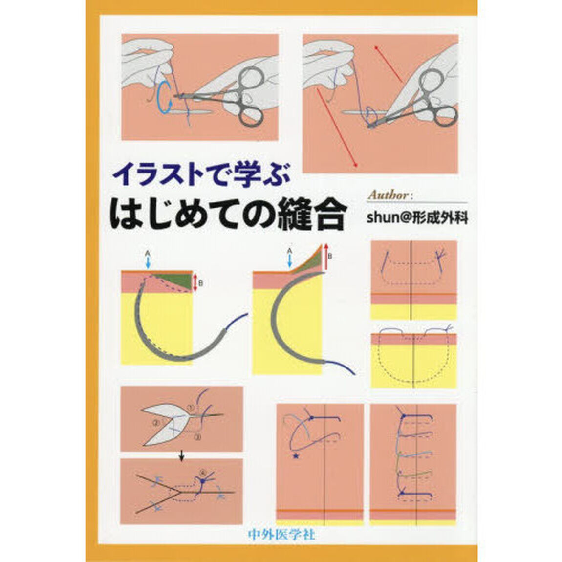 イラストで学ぶはじめての縫合