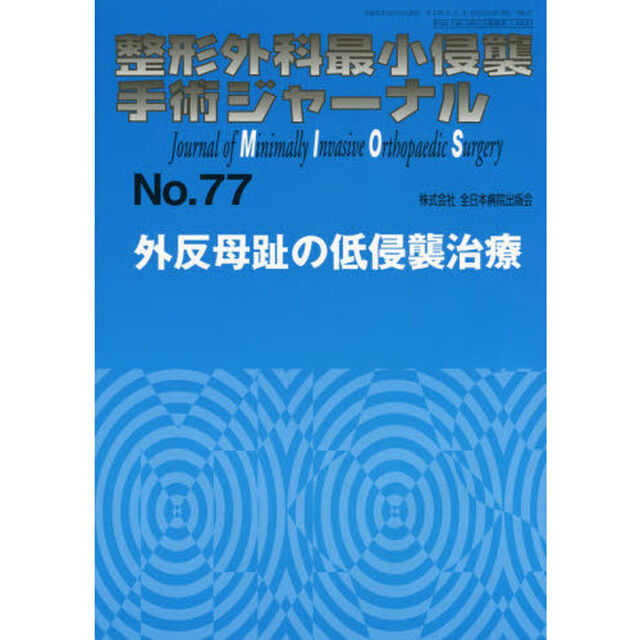 整形外科最小侵襲手術ジャーナル　Ｎｏ．７７「外反母趾の低侵襲治療」