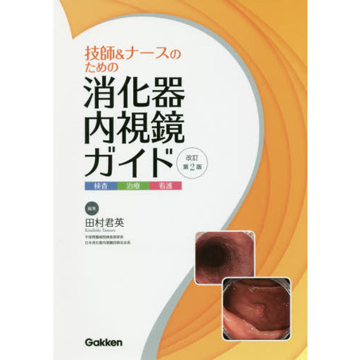 技師＆ナースのための消化器内視鏡ガイド　検査　治療　看護「改訂第２版」