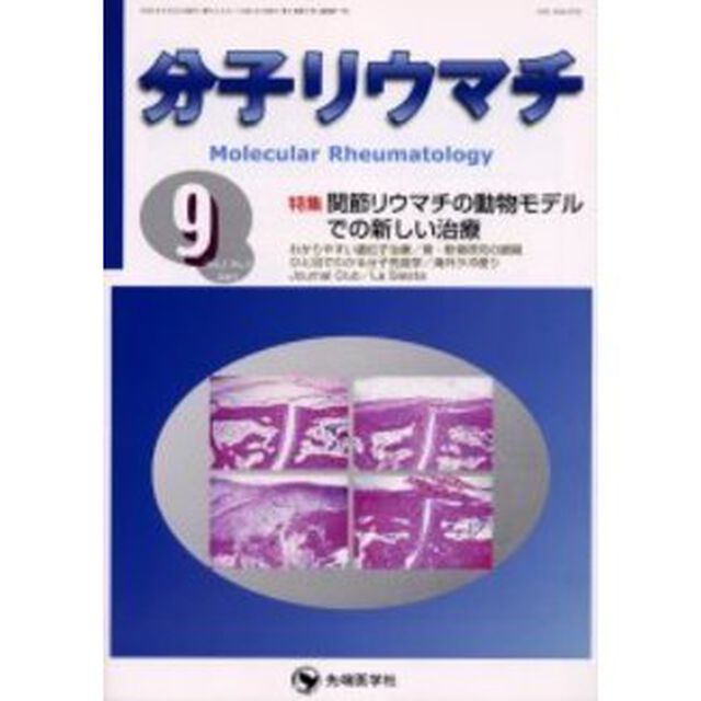 分子リウマチ　Ｖｏｌ．２Ｎｏ．３（２００５－９）「特集関節リウマチの動物モデルでの新しい治療」