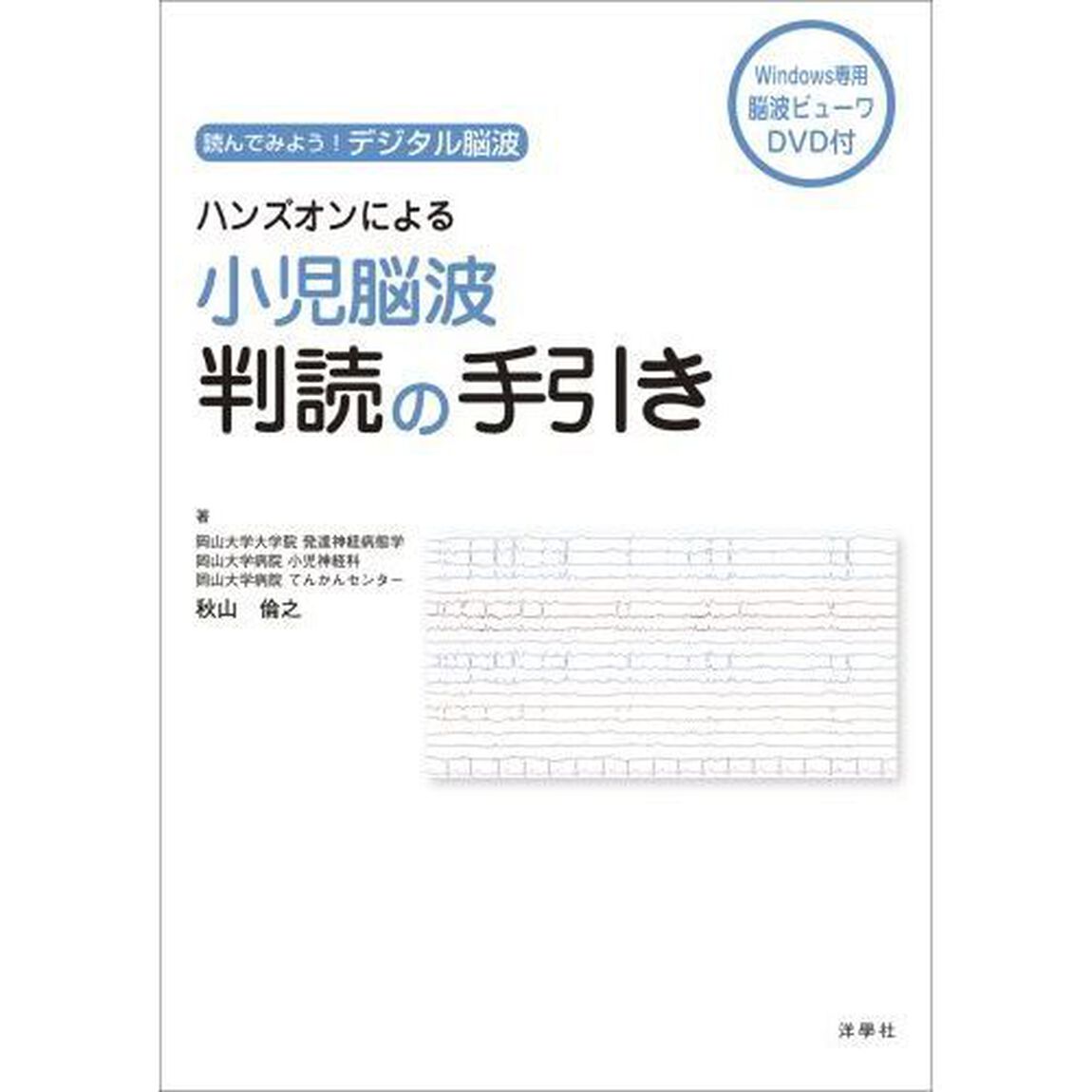 ハンズオンによる小児脳波判読の手引き　読んでみよう！デジタル脳波