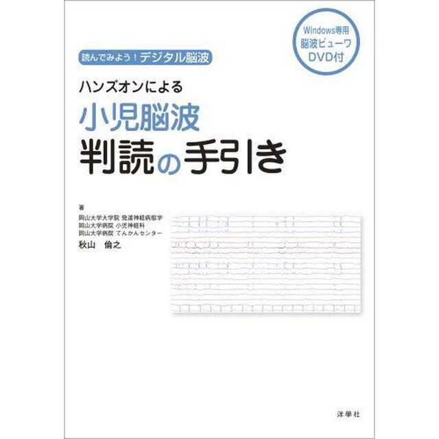 ハンズオンによる小児脳波判読の手引き　読んでみよう！デジタル脳波