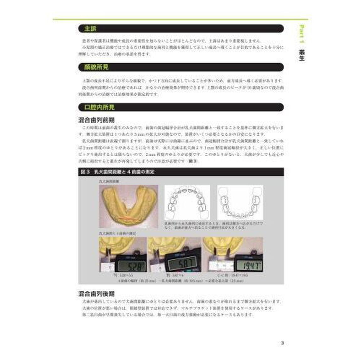 臨床家のための床矯正治療　不正咬合別のアプローチ　１「叢生・上顎前突・過蓋咬合」