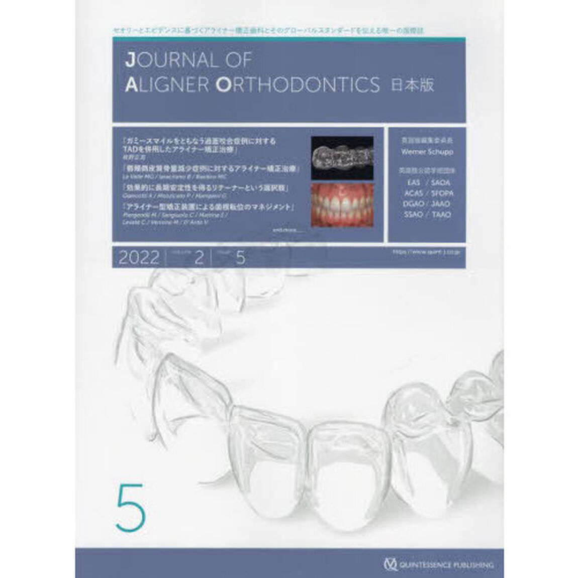 ＪＯＵＲＮＡＬ　ＯＦ　ＡＬＩＧＮＥＲ　ＯＲＴＨＯＤＯＮＴＩＣＳ日本版　ｖｏｌ．２ｉｓｓｕｅ５（２０２２）「ガミースマイルをともなう過蓋咬合症例に対するＴＡＤを併用したアライナー矯正治療ほか」