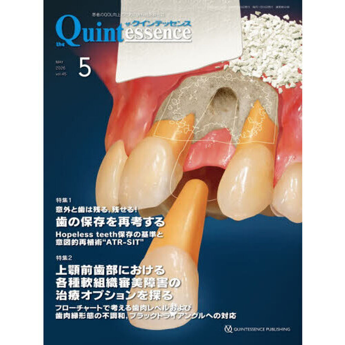 ザ・クインテッセンス　ｖｏｌ．４５／ｎｏ．５（２０２６ＭＡＹ）