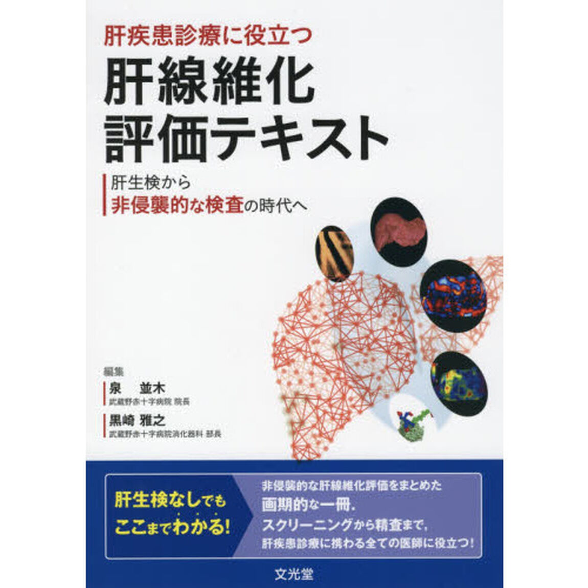 肝疾患診療に役立つ肝線維化評価テキスト　肝生検から非侵襲的な検査の時代へ
