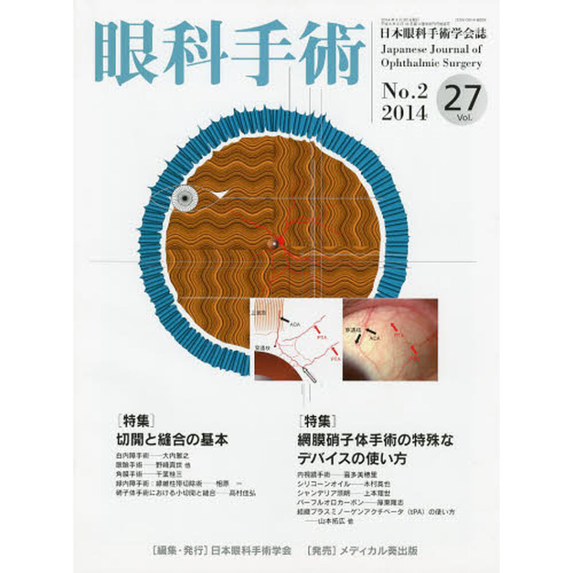 眼科手術　日本眼科手術学会誌　Ｖｏｌ．２７Ｎｏ．２（２０１４）「特集切開と縫合の基本／網膜硝子体手術の特殊なデバイスの使い方」
