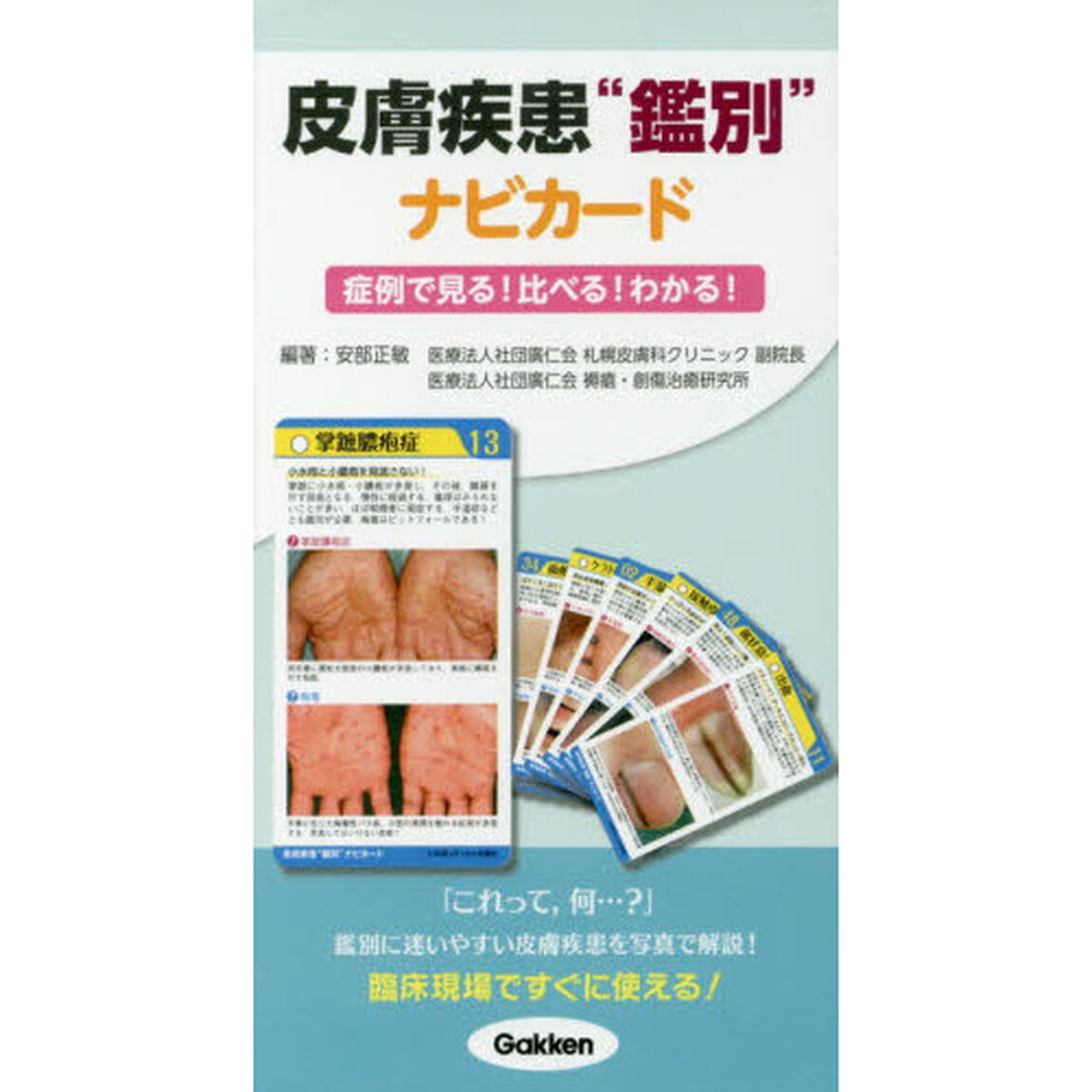 皮膚疾患鑑別ナビカード　症例で見る！比べる！わかる！