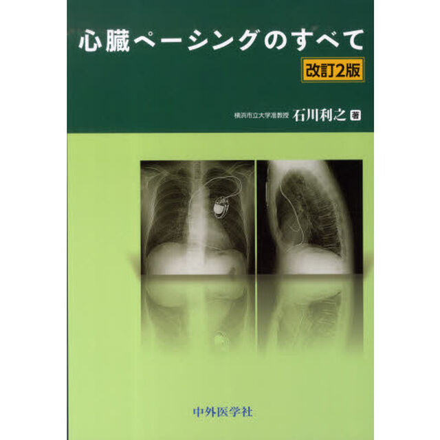 心臓ペーシングのすべて「改訂２版」