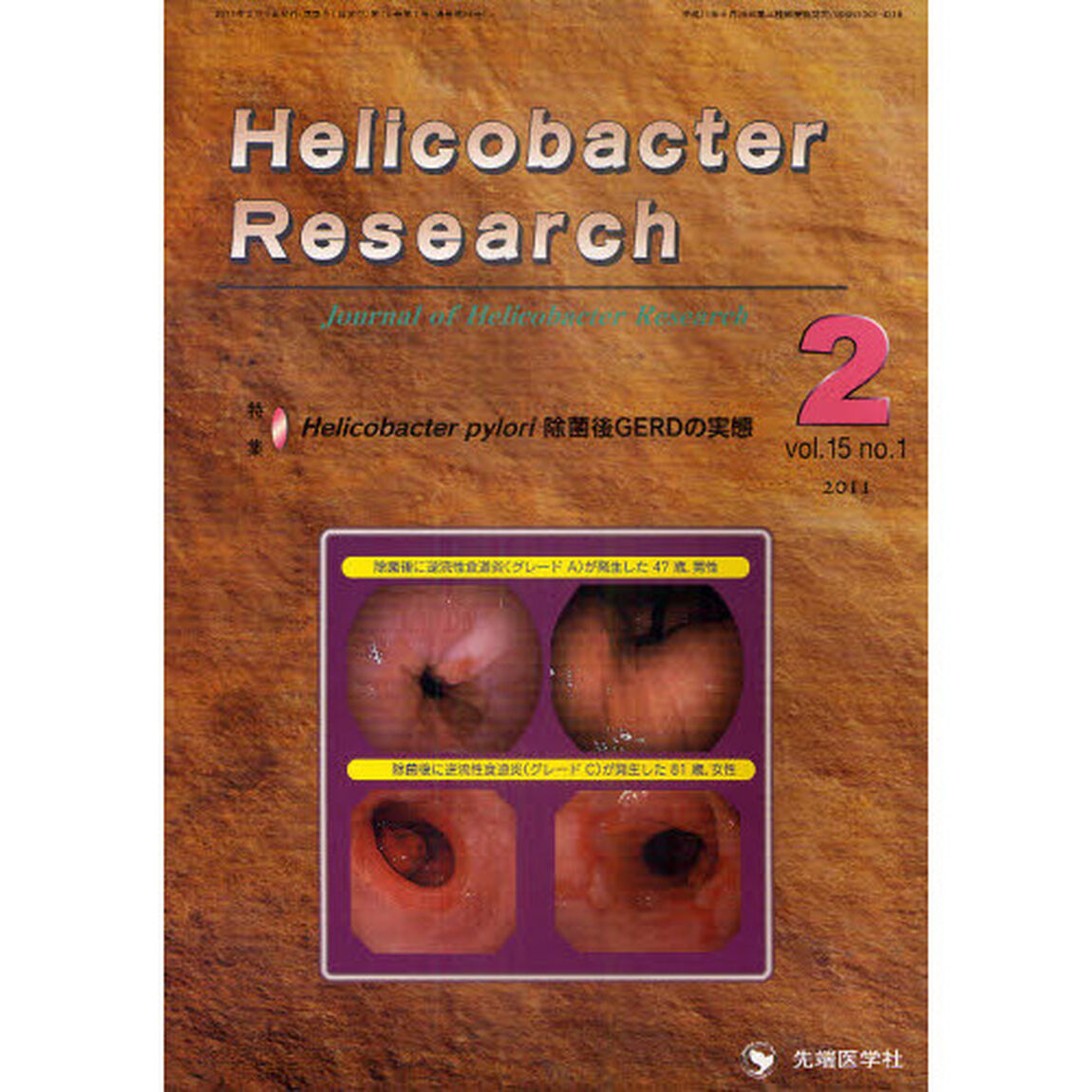 Ｈｅｌｉｃｏｂａｃｔｅｒ　Ｒｅｓｅａｒｃｈ　Ｊｏｕｒｎａｌ　ｏｆ　Ｈｅｌｉｃｏｂａｃｔｅｒ　Ｒｅｓｅａｒｃｈ　ｖｏｌ．１５ｎｏ．１（２０１１－２）「特集Ｈｅｌｉｃｏｂａｃｔｅｒ　ｐｙｌｏｒｉ除菌後ＧＥＲＤの実態」