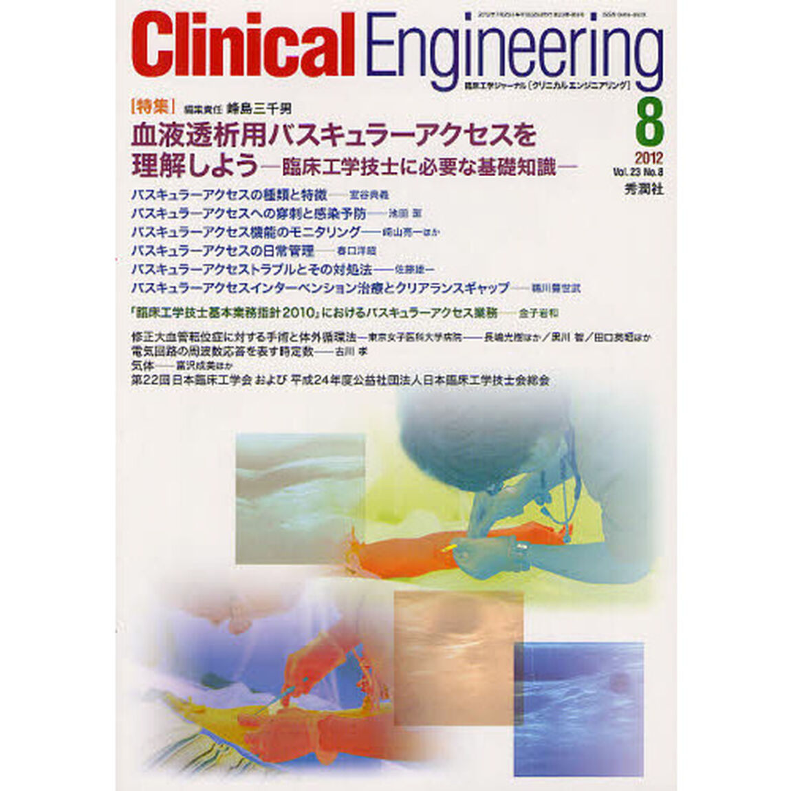 クリニカルエンジニアリング　臨床工学ジャーナル　Ｖｏｌ．２３Ｎｏ．８（２０１２－８月号）「特集血液透析用バスキュラーアクセスを理解しよう」