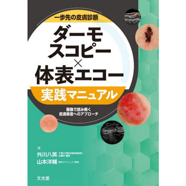 一歩先の皮膚診断ダーモスコピー&times;体表エコー実践マニュアル　画像で読み解く皮膚疾患へのアプローチ