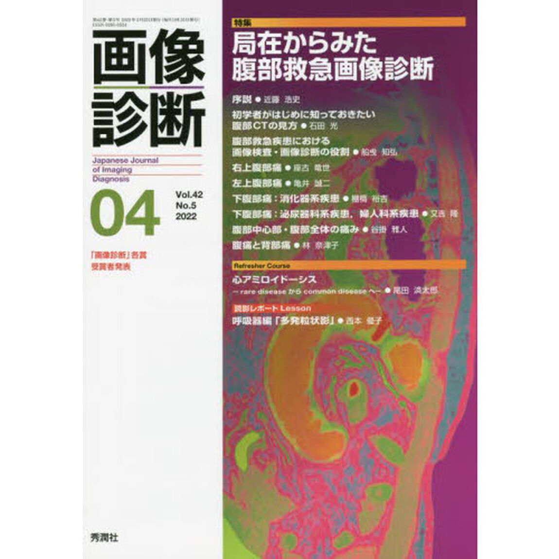 画像診断　Ｖｏｌ．４２Ｎｏ．５（２０２２－０４）「特集局在からみた腹部救急画像診断」