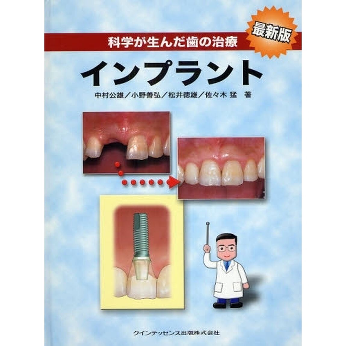 科学が生んだ歯の治療インプラント「最新版」