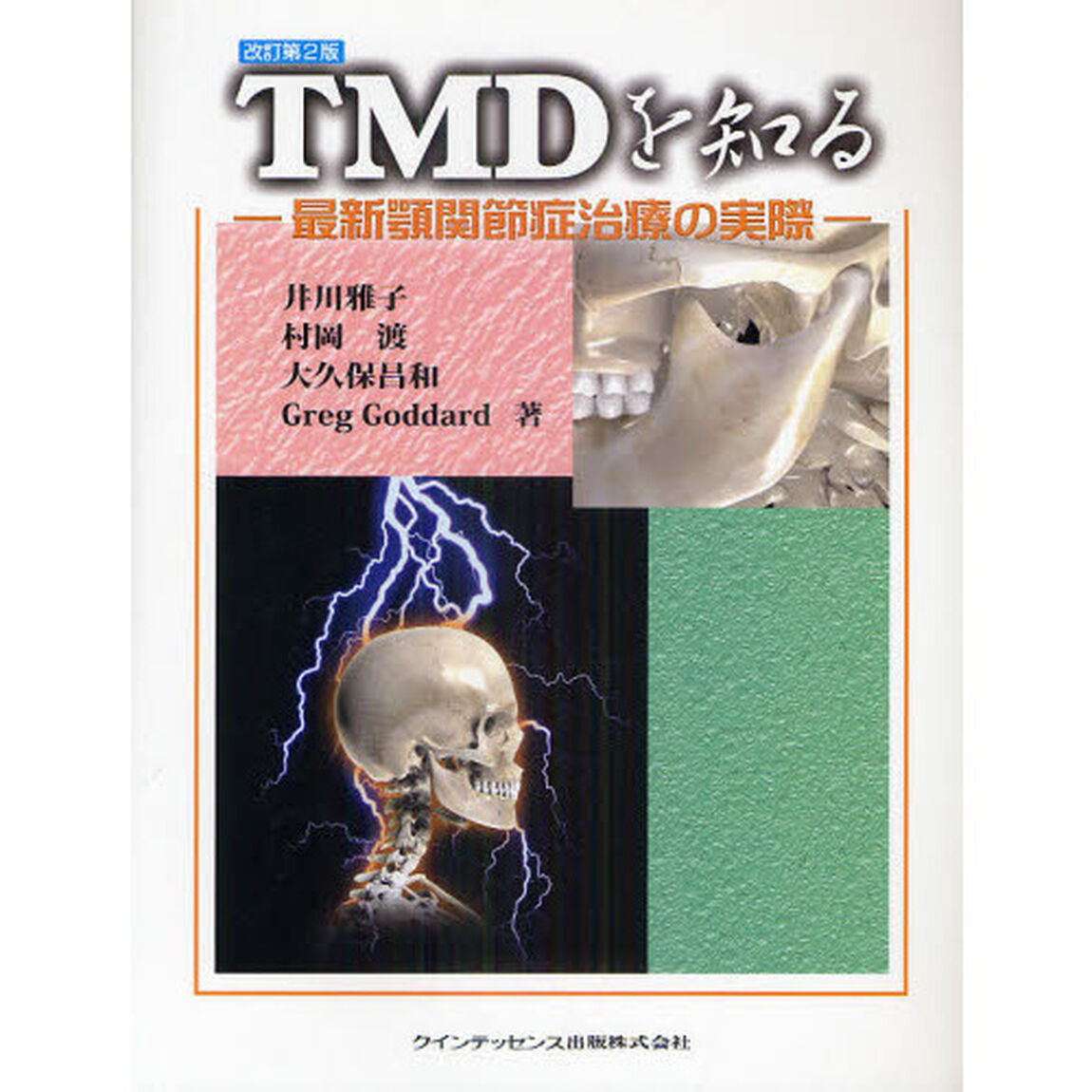 ＴＭＤを知る　最新顎関節症治療の実際「改訂第２版」