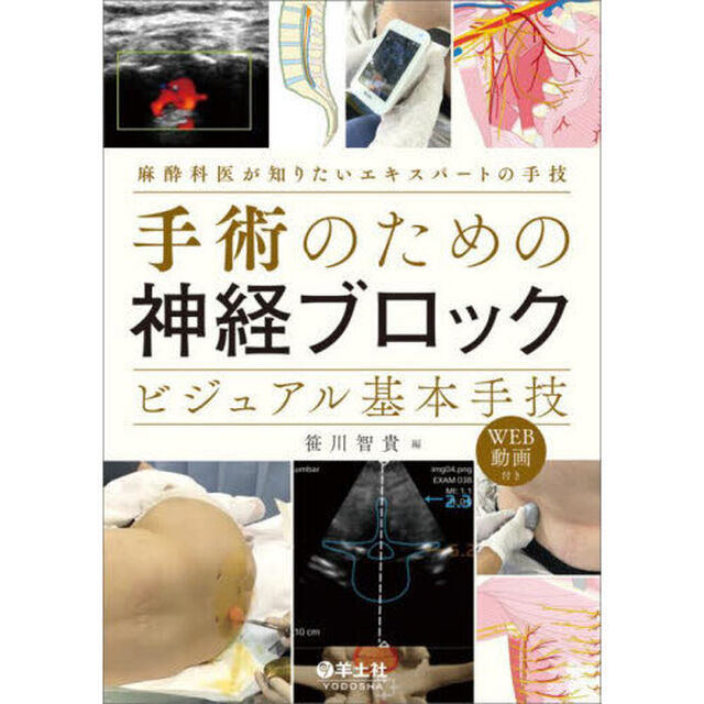 手術のための神経ブロックビジュアル基本手技　麻酔科医が知りたいエキスパートの手技