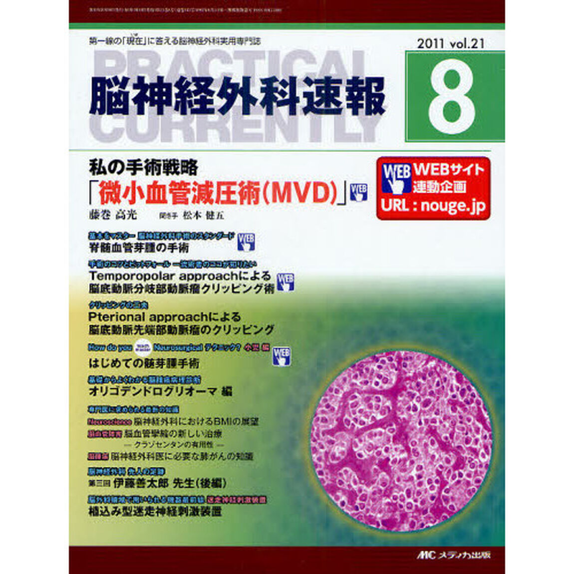 脳神経外科速報　第２１巻８号（２０１１－８）「私の手術戦略「微小血管減圧術〈ＭＶＤ〉」」