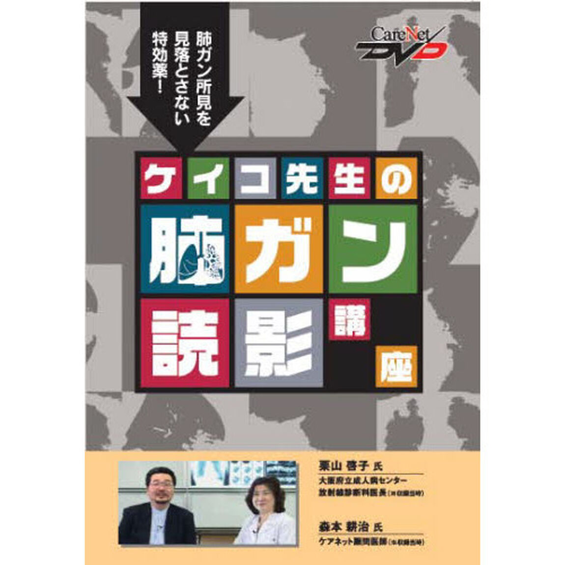 ケイコ先生の肺ガン読影講座