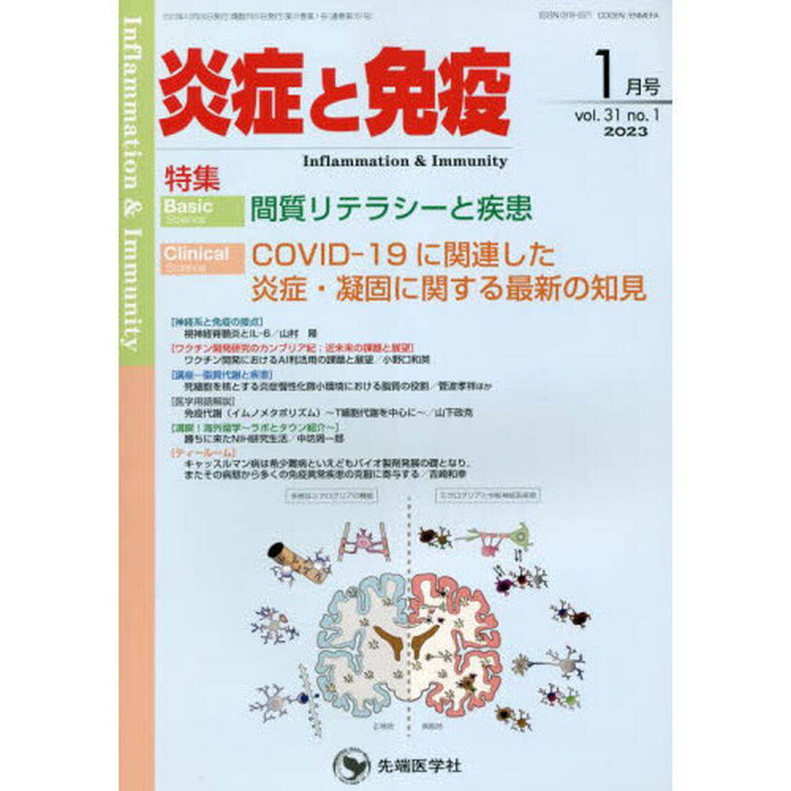 炎症と免疫　ｖｏｌ．３１ｎｏ．１（２０２３－１月号）「Ｂａｓｉｃ間質リテラシーと疾患　Ｃｌｉｎｉｃａｌ　ＣＯＶＩＤ－１９に関連した炎症・凝固に関する最新の知見」