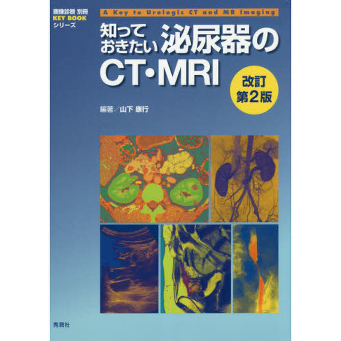 知っておきたい泌尿器のＣＴ・ＭＲＩ「改訂第２版」