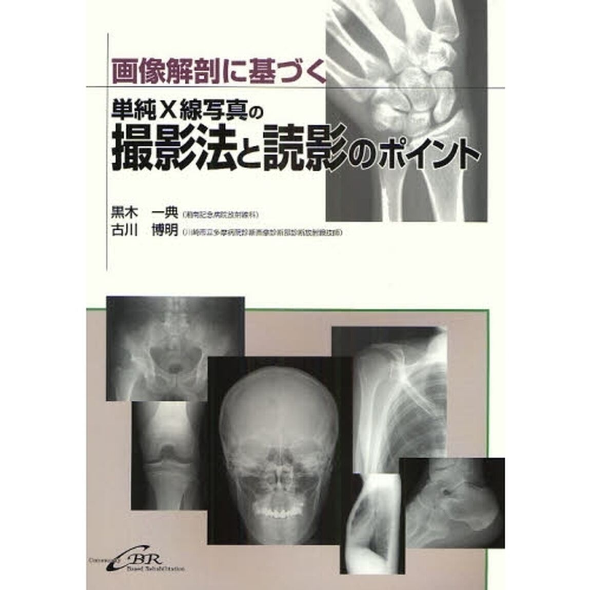 画像解剖に基づく単純Ｘ線写真の撮影法と読影のポイント