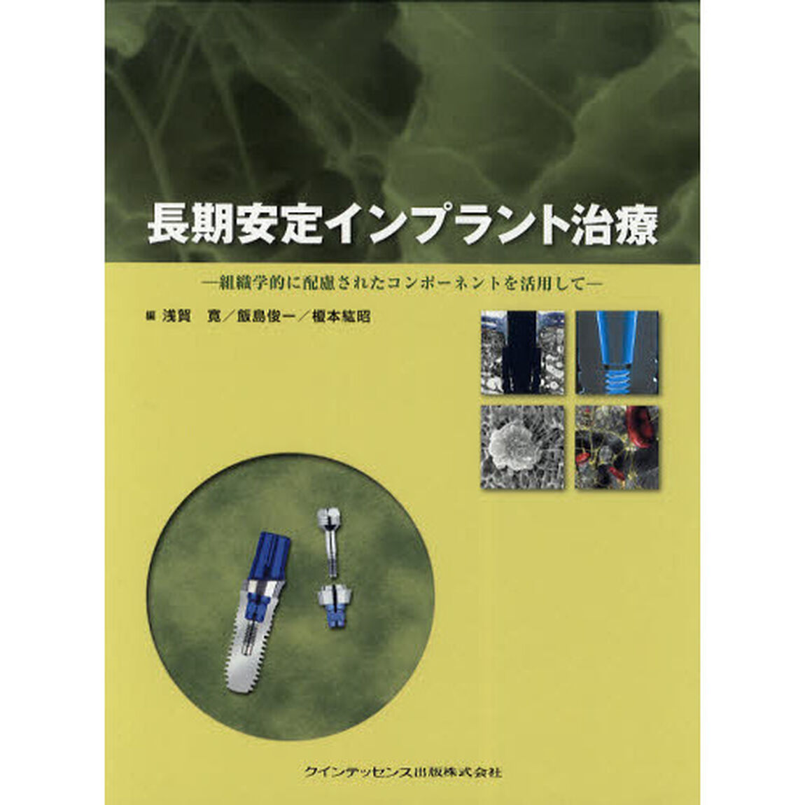 長期安定インプラント治療　組織学的に配慮されたコンポーネントを活用して