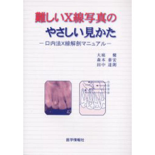 難しいＸ線写真のやさしい見かた　口内法Ｘ線解剖マニュアル