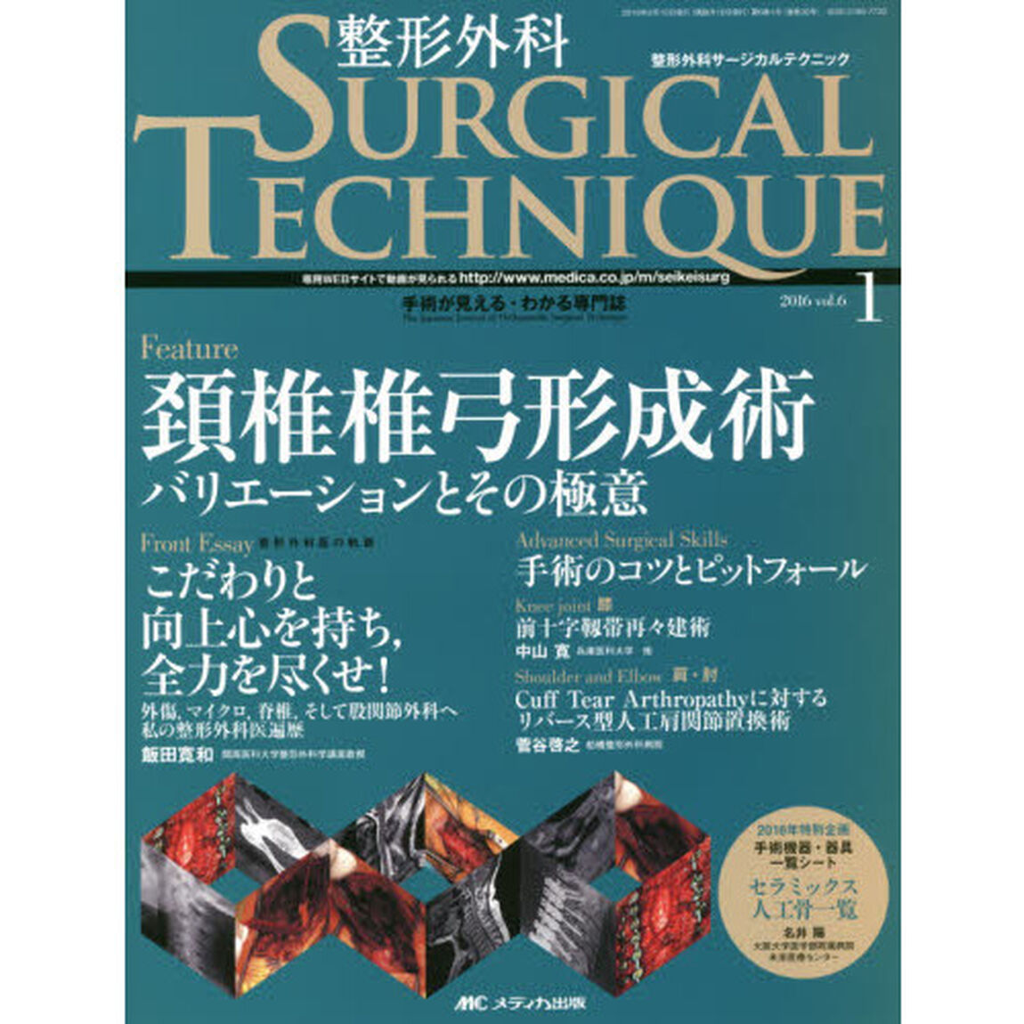 整形外科サージカルテクニック　手術が見える・わかる専門誌　第６巻１号（２０１６－１）「頚椎椎弓形成術　バリエーションとその極意」