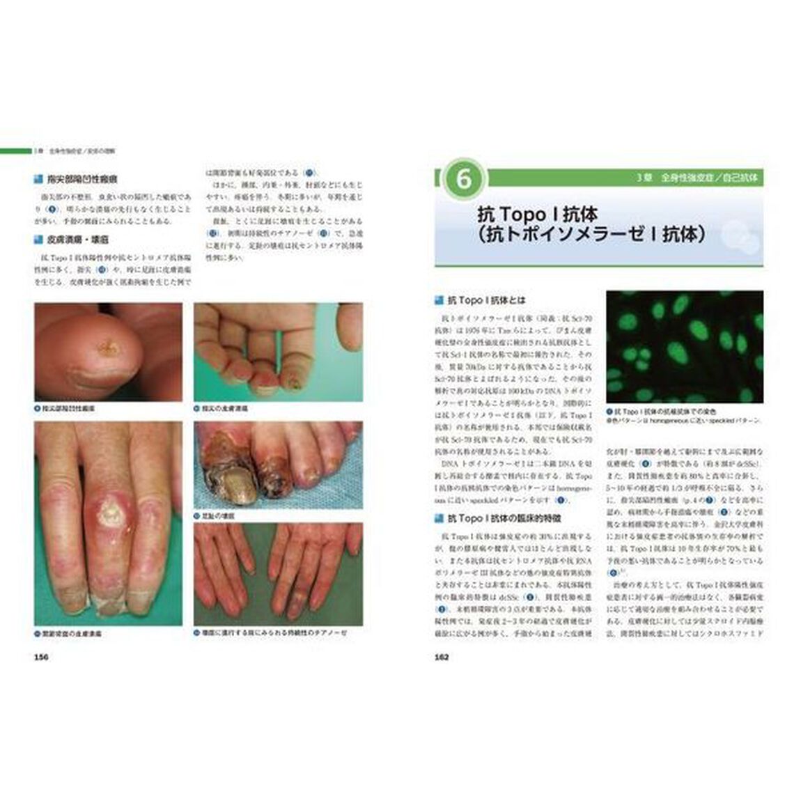 皮膚科膠原病　皮診から全身を診る