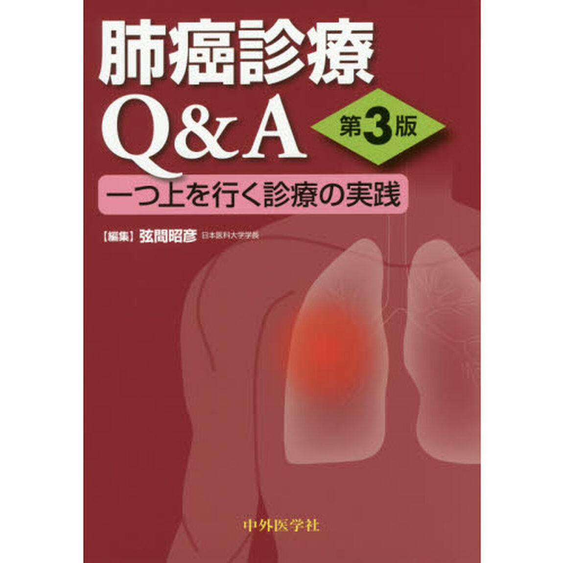 肺癌診療Ｑ＆Ａ　一つ上を行く診療の実践「第３版」