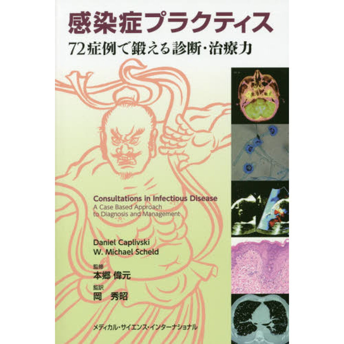 感染症プラクティス　７２症例で鍛える診断・治療力