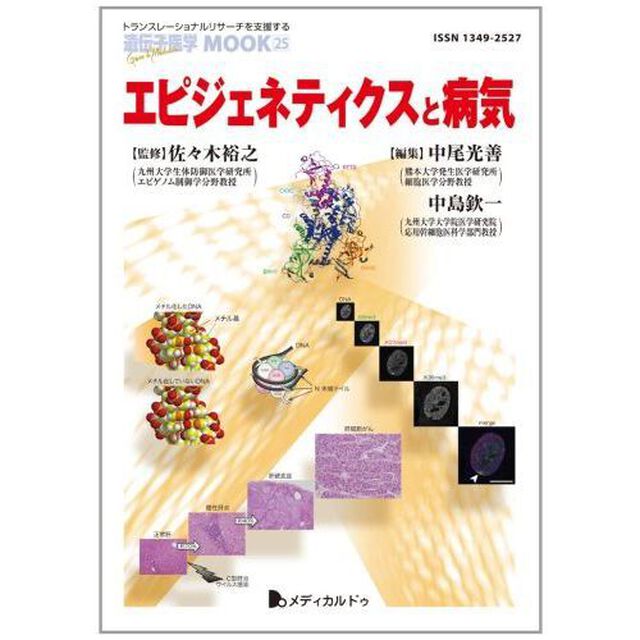 エピジェネティクスと病気