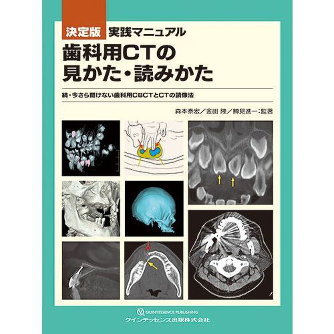 実践マニュアル歯科用ＣＴの見かた・読みかた　決定版　今さら聞けない歯科用ＣＢＣＴとＣＴの読像法　続