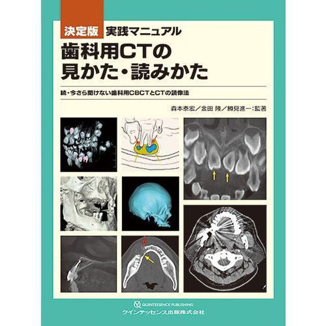 実践マニュアル歯科用ＣＴの見かた・読みかた　決定版　今さら聞けない歯科用ＣＢＣＴとＣＴの読像法　続