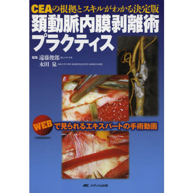 頚動脈内膜剥離術プラクティス　ＣＥＡの根拠とスキルがわかる決定版　ＷＥＢで見られるエキスパートの手術動画