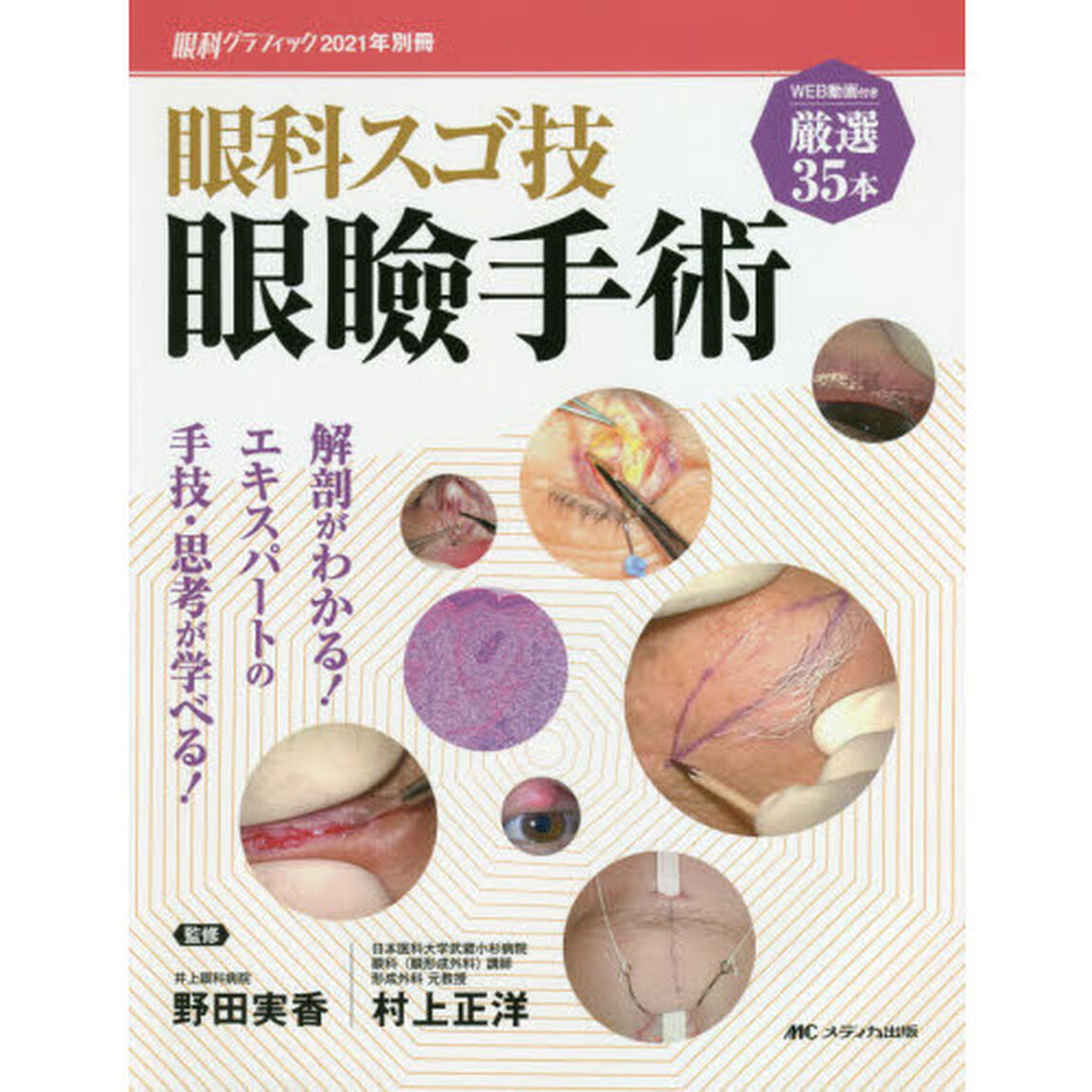 眼科スゴ技眼瞼手術　ＷＥＢ動画付き厳選３５本　解剖がわかる！エキスパートの手技・思考が学べる！