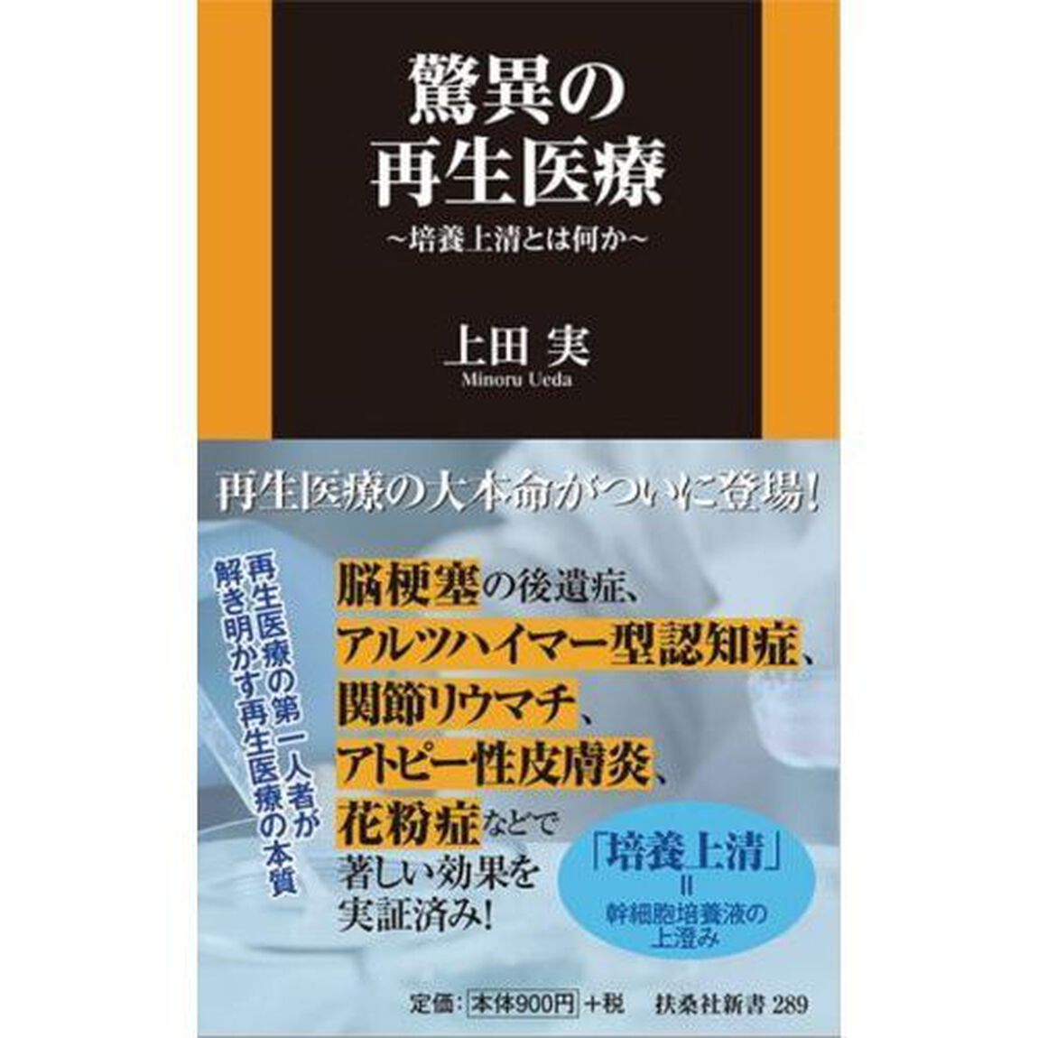 驚異の再生医療　培養上清とは何か