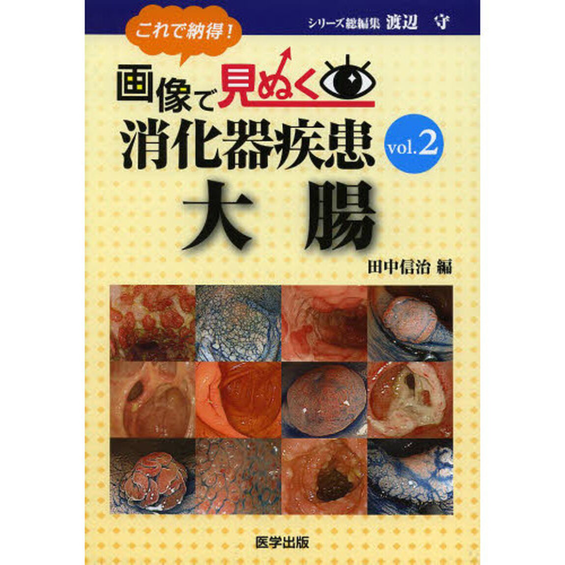これで納得！画像で見ぬく消化器疾患　ｖｏｌ．２「大腸」