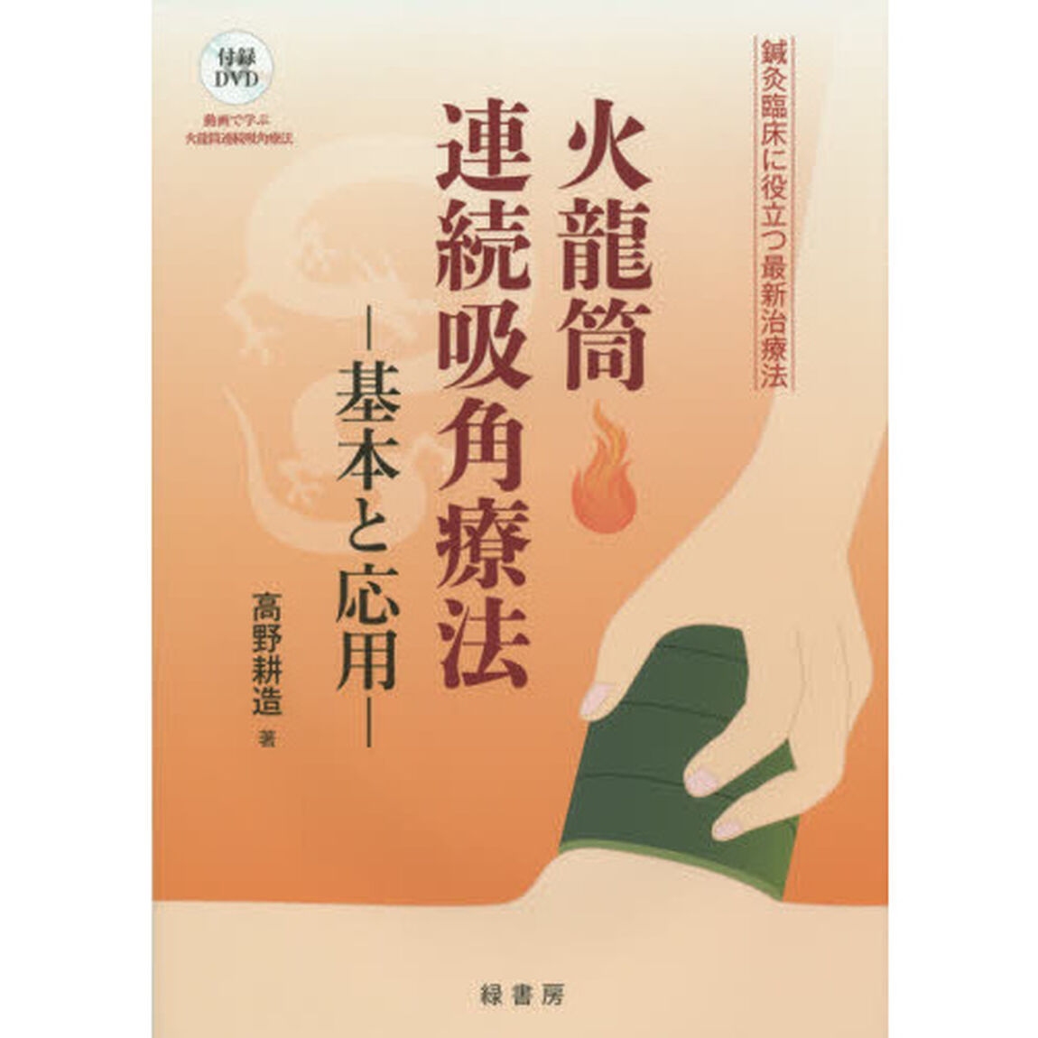 火龍筒連続吸角療法　基本と応用　鍼灸臨床に役立つ最新治療法