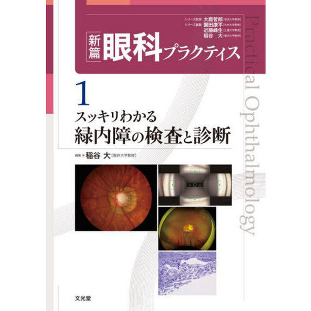新篇眼科プラクティス　１「スッキリわかる緑内障の検査と診断」