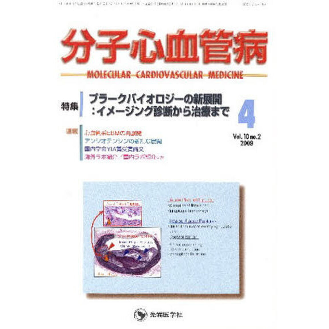 分子心血管病　１０－　２