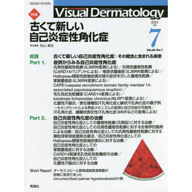 Ｖｉｓｕａｌ　Ｄｅｒｍａｔｏｌｏｇｙ　目でみる皮膚科学　Ｖｏｌ．２０Ｎｏ．７（２０２１－７）「特集古くて新しい自己炎症性角化症」