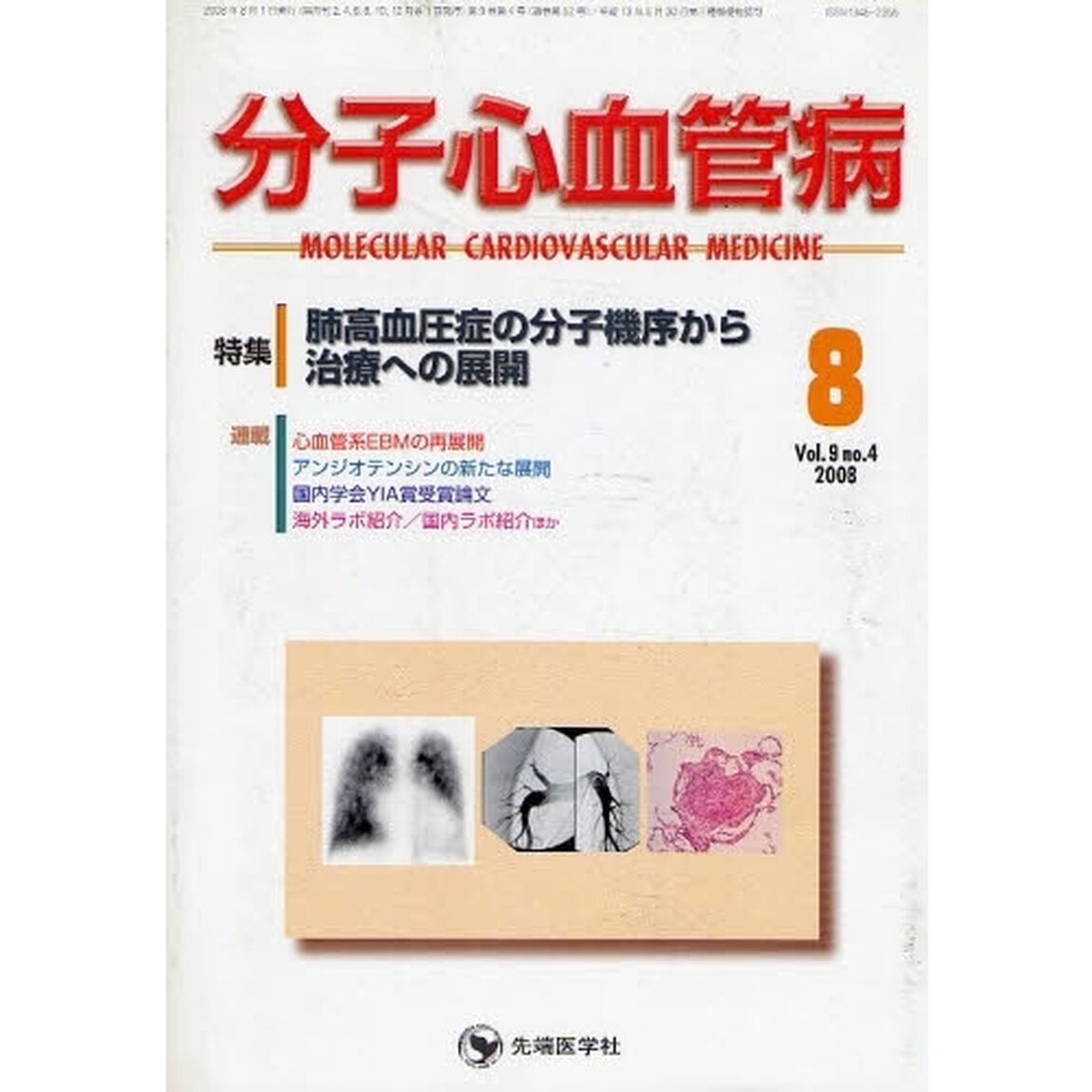 分子心血管病　ｖｏｌ．９ｎｏ．４（２００８－８）「特集・肺高血圧症の分子機序から治療への展開」