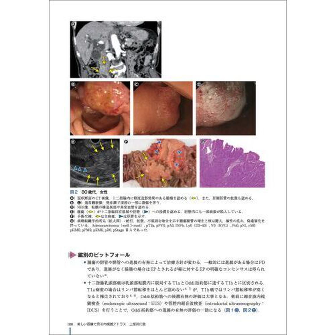 美しい画像で見る内視鏡アトラス上部消化管　腫瘍から感染性・炎症性疾患まで、典型例とピットフォール画像で鑑別点を理解する