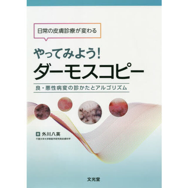 やってみよう！ダーモスコピー　日常の皮膚診療が変わる　良・悪性病変の診かたとアルゴリズム