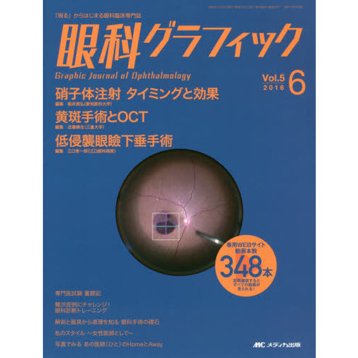 眼科グラフィック　「視る」からはじまる眼科臨床専門誌　第５巻６号（２０１６）「硝子体注射タイミングと効果ほか　特集〈黄斑手術とＯＣＴ／低侵襲眼瞼下垂手術〉」